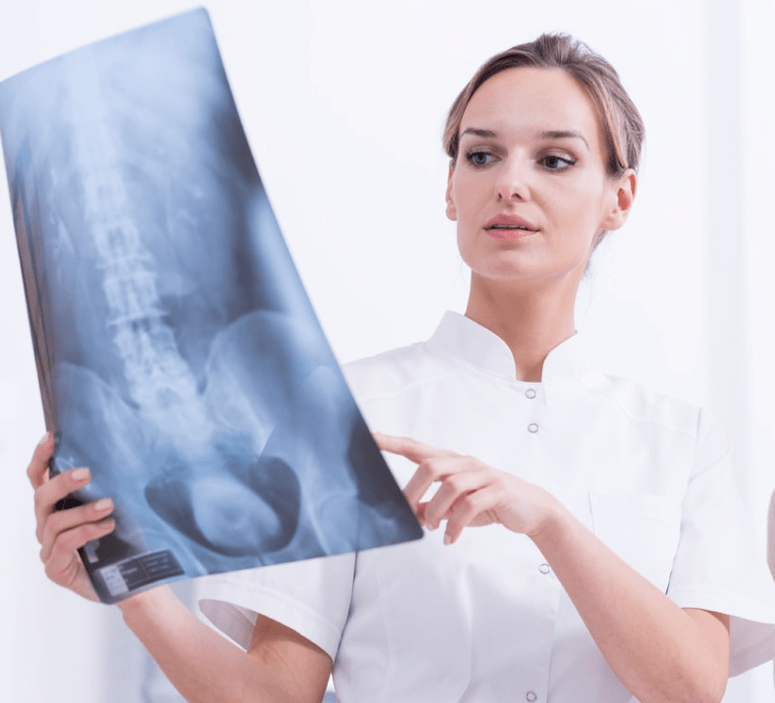 Dijagnoza torakalne osteohondroze rendgenskim pregledom